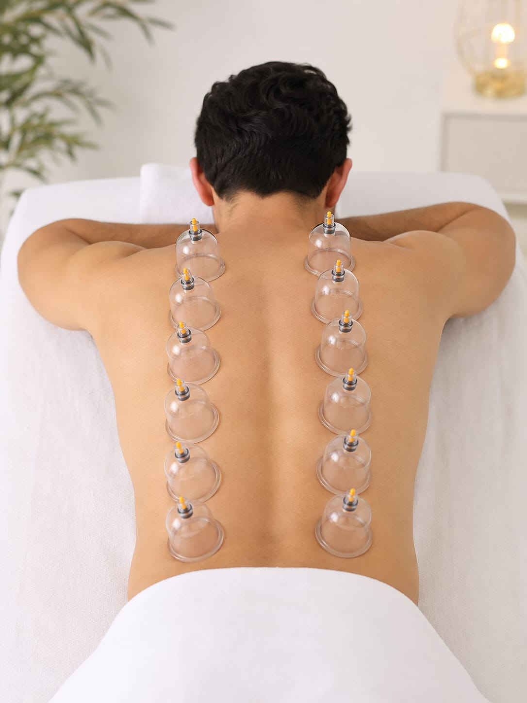 Cupping Therapy (Hijama) - 2