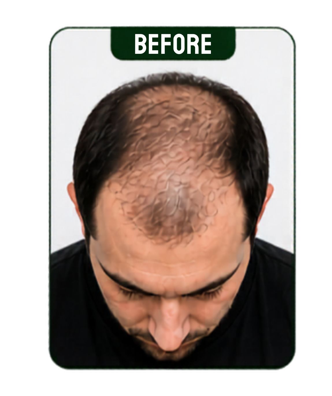 Hair Treatment - 2